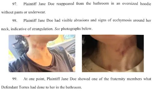 Court filing photos showing bruising on the plaintiff's neck